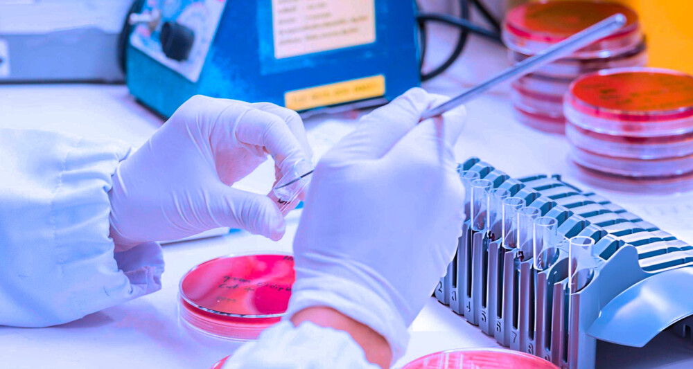 EN 14476: Virucidal Test For Antiseptics And Disinfectants